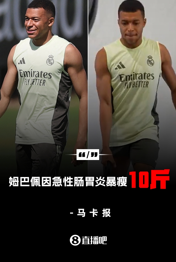 马卡报道：姆巴佩因肠胃炎折磨，体重骤降四至五公斤